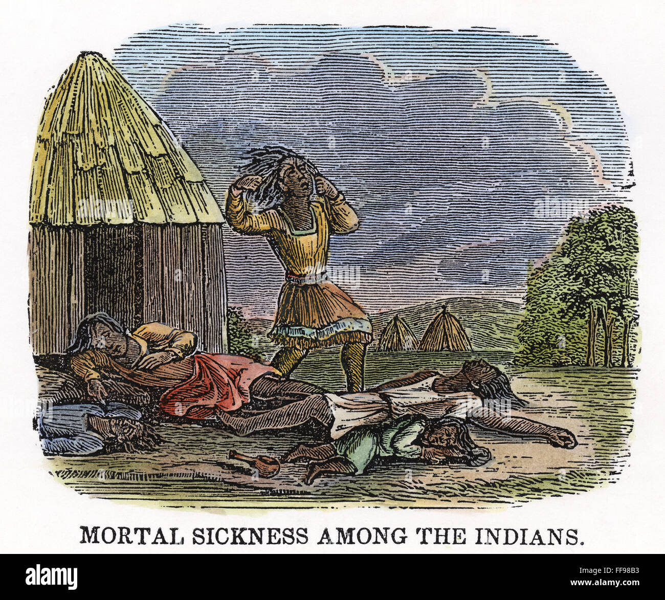 Les Américains autochtones : LA VARIOLE, 1853. NNative /American victimes d'une épidémie de variole transmise par les colons blancs en Amérique. La gravure sur bois, cuisine américaine, 1853. Banque D'Images