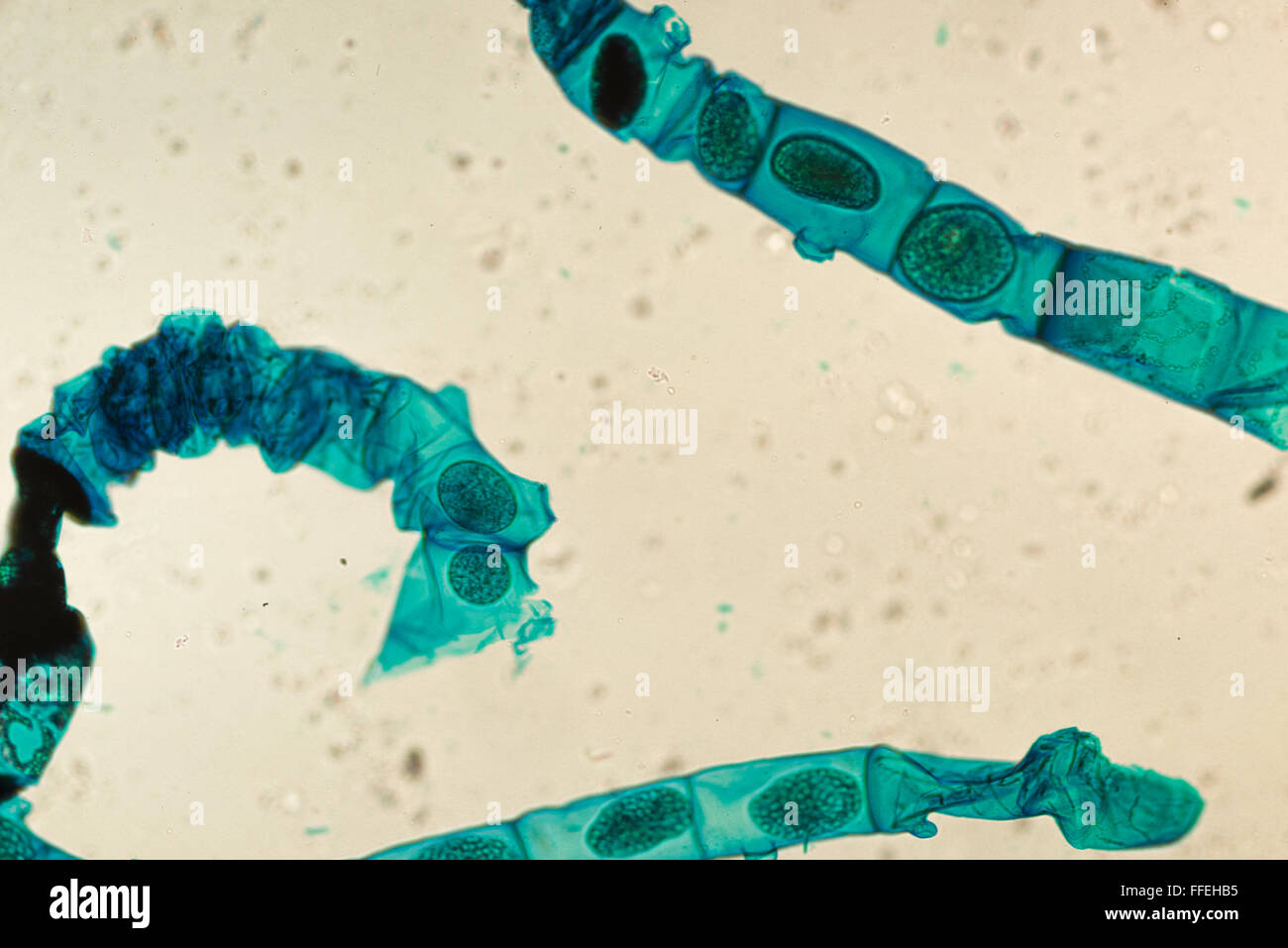 Image microscopique des cellules végétales alga Banque D'Images