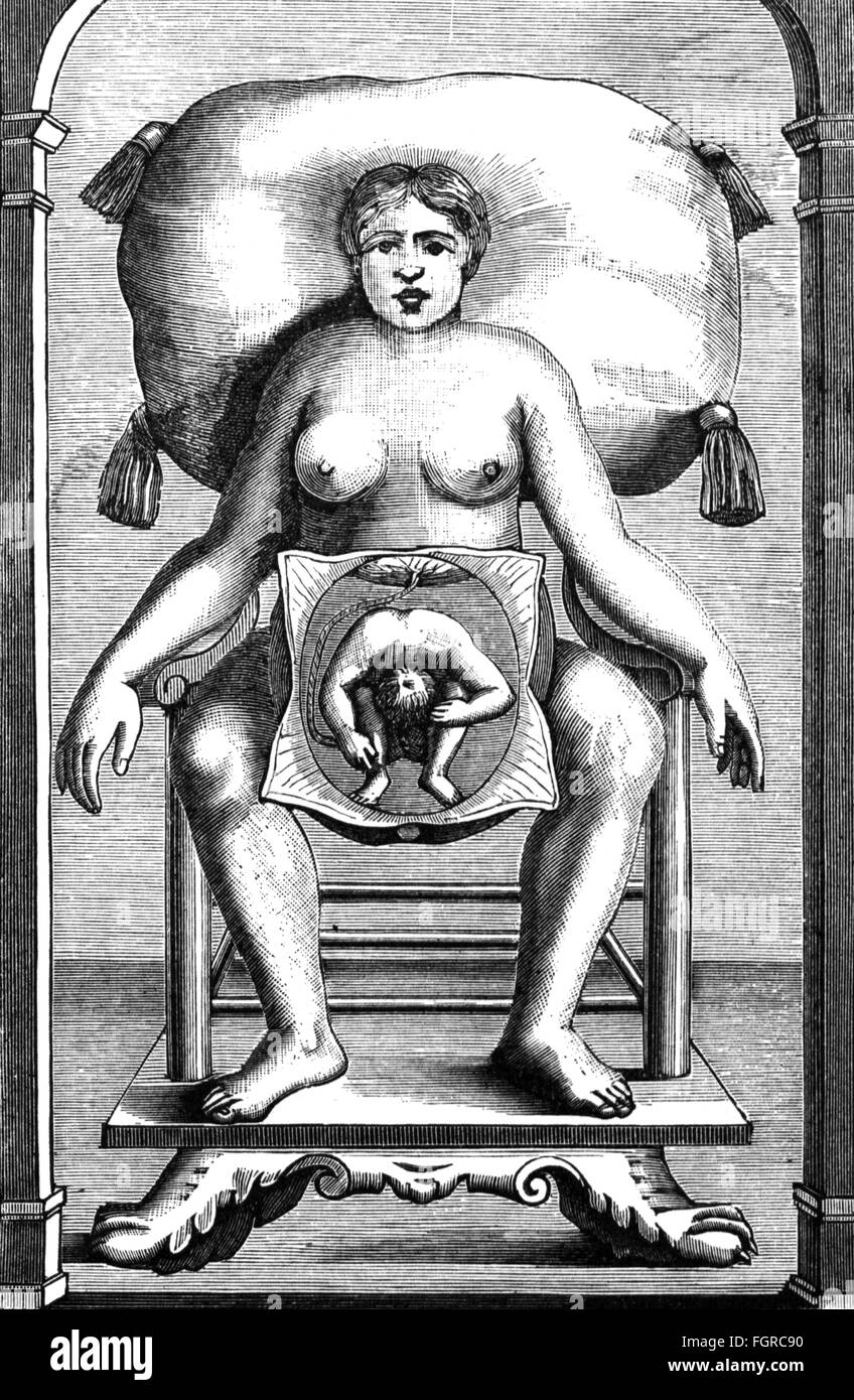 La médecine, la naissance / gynécologie, schéma, photo d'une femme enceinte à l'embryon en position d'approvisionnement, gravure sur cuivre, 1766, copyright de l'artiste n'a pas à être effacée Banque D'Images