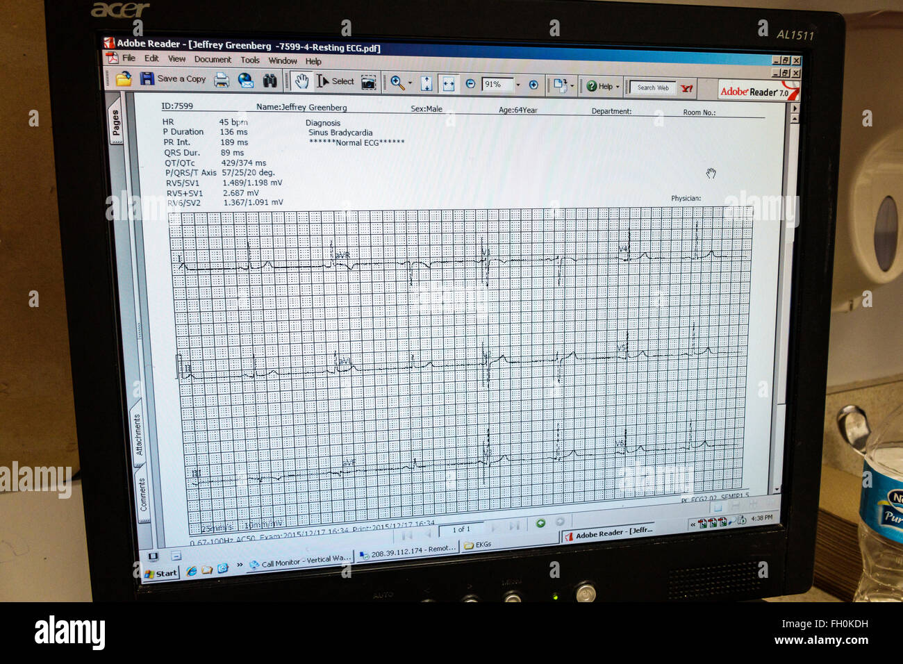 Floride,Sud,FL,Miami Beach,Centre médical Mount Mt Sinai,centre,hôpital,cabinet du médecin,moniteur,écran,ECG,EKG,repos,électrocardiogramme,coeur,rhyt Banque D'Images