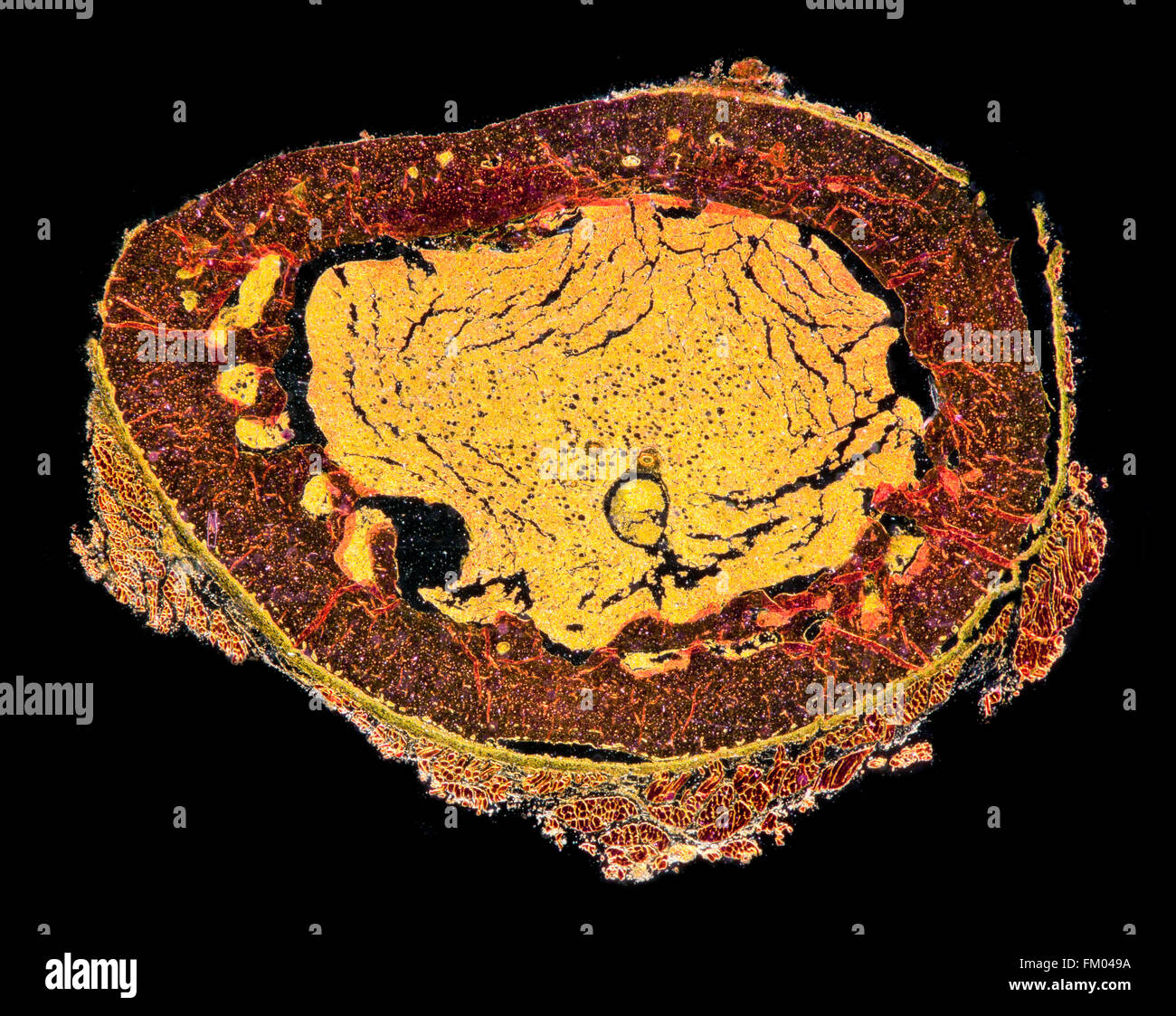 Fémur foetaux humains darkfield photomicrographie TS. Banque D'Images