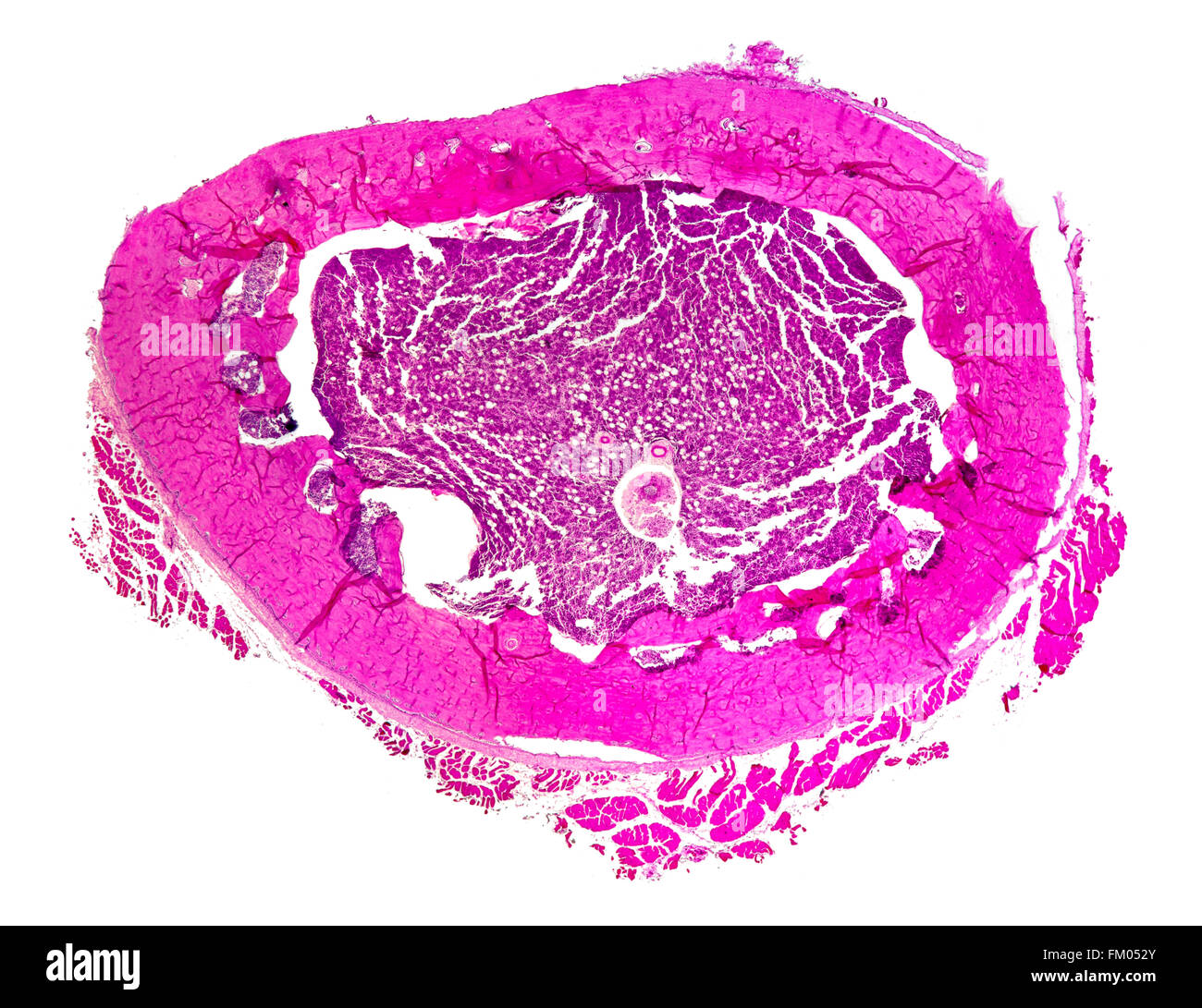 Fémur fœtal humain. TS section vitrail, fond clair photomicrographie Banque D'Images