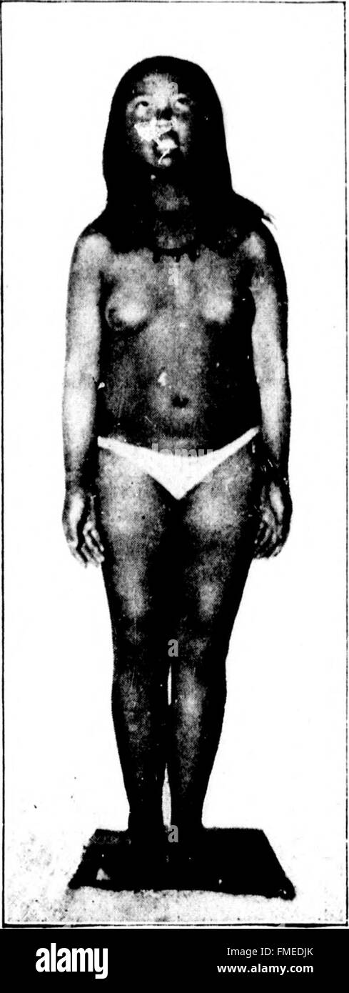 Un récit racontant la vie et le travail le long des rives et de la calotte glaciaire du nord du Groenland entre 1886 et 1897, détaillant l'exploration et la survie dans l'Arctique. Banque D'Images