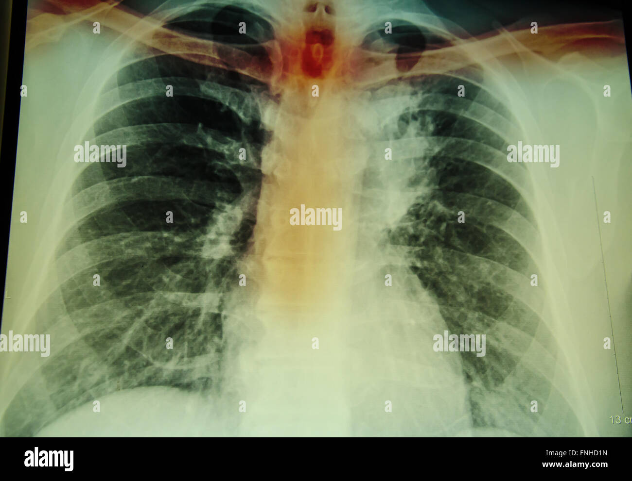 Radiographie du rachis et de l'examen pour le diagnostic des blessures cervicales Banque D'Images