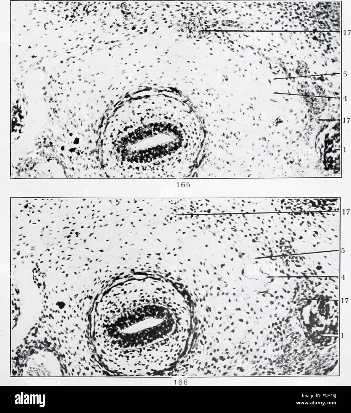 Cette étude de 1911 détaille l'anatomie et le développement du système lymphatique chez les chats domestiques, en se concentrant sur la structure et la fonction des vaisseaux systémiques. Banque D'Images