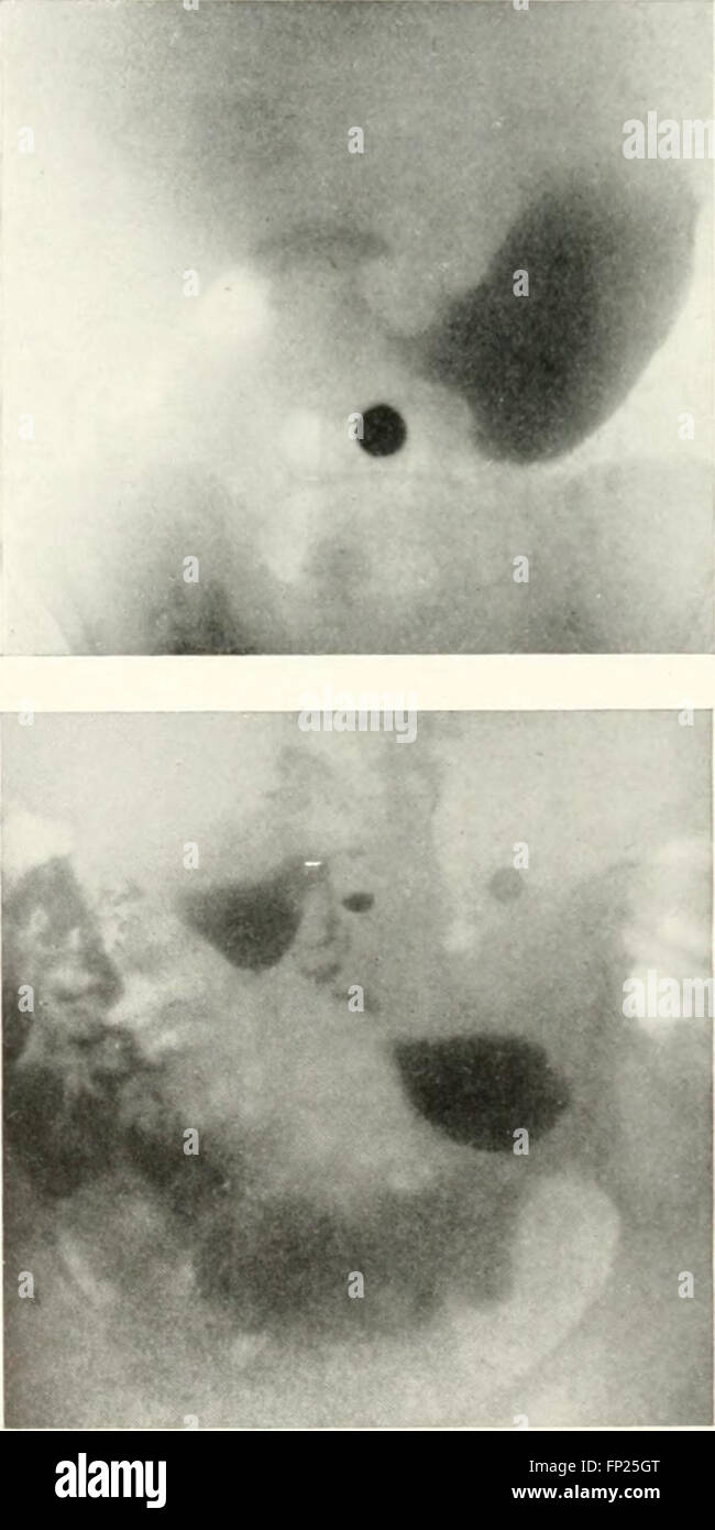 La radiographie, la thérapeutique des rayons x et le radium thérapie (1915) Banque D'Images