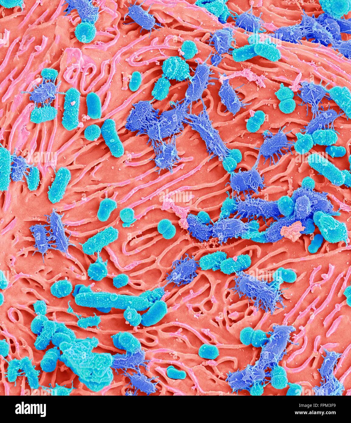 Les bactéries orales. Couleur de l'analyse - Microphotographie (SEM) de bactéries orales mixte rattaché à une cellule buccale (rose) de la Banque D'Images