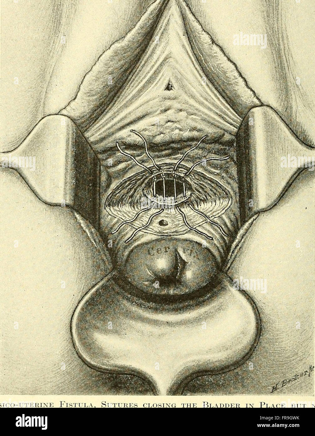 'Operative Gynecology' (1906) se concentre sur les procédures chirurgicales et les traitements liés à la santé reproductive féminine, y compris les techniques et les progrès en chirurgie gynécologique. Banque D'Images