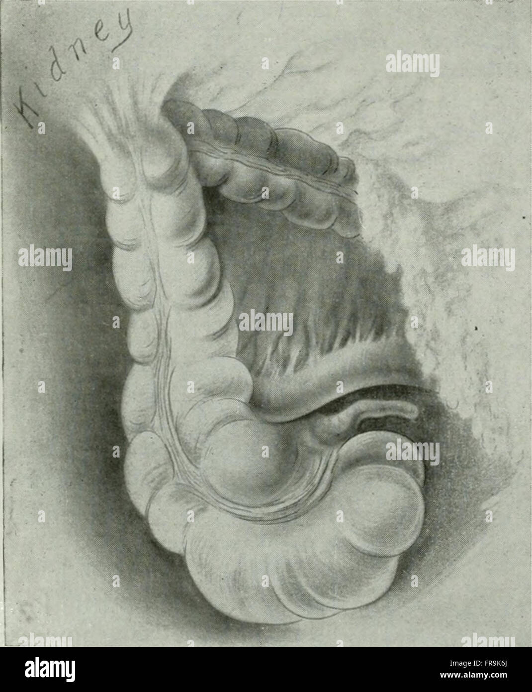 Le journal américain de l'roentgoenology, radium thérapie et médecine nucléaire (1906) Banque D'Images