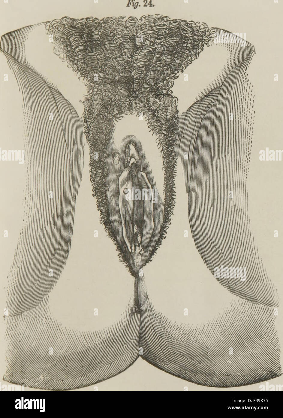 Médecin conseil et guide mariage - représentant toutes les maladies des organes génitaux de l'homme et la femme (1864) Banque D'Images