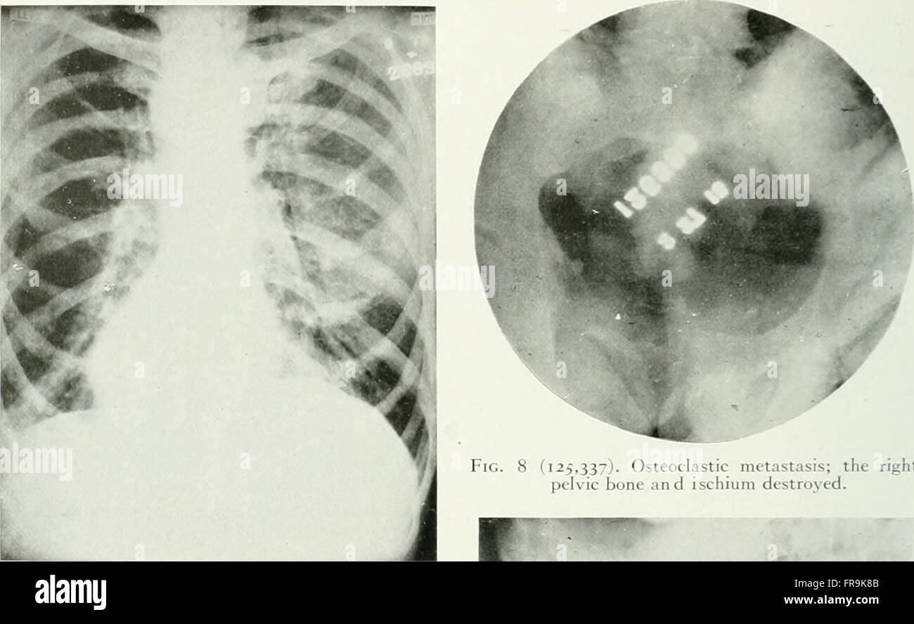 Le journal américain de l'roentgoenology, radium thérapie et médecine nucléaire (1906) Banque D'Images