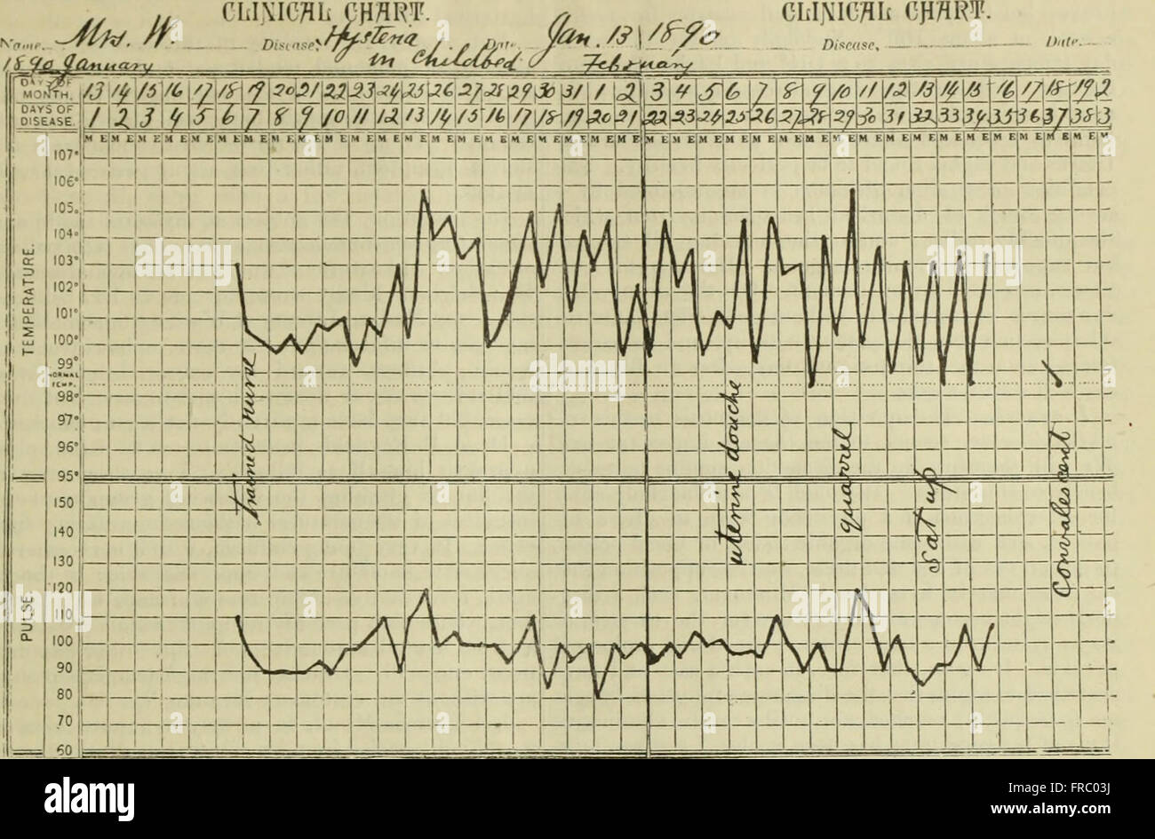 Cette publication de 1890 présente des articles médicaux sur une variété de sujets, y compris la chirurgie, l'anatomie et les traitements. Il offre des recherches scientifiques et des progrès dans le domaine médical, en se concentrant sur les développements dans la chirurgie et d'autres pratiques de soins de santé. Banque D'Images