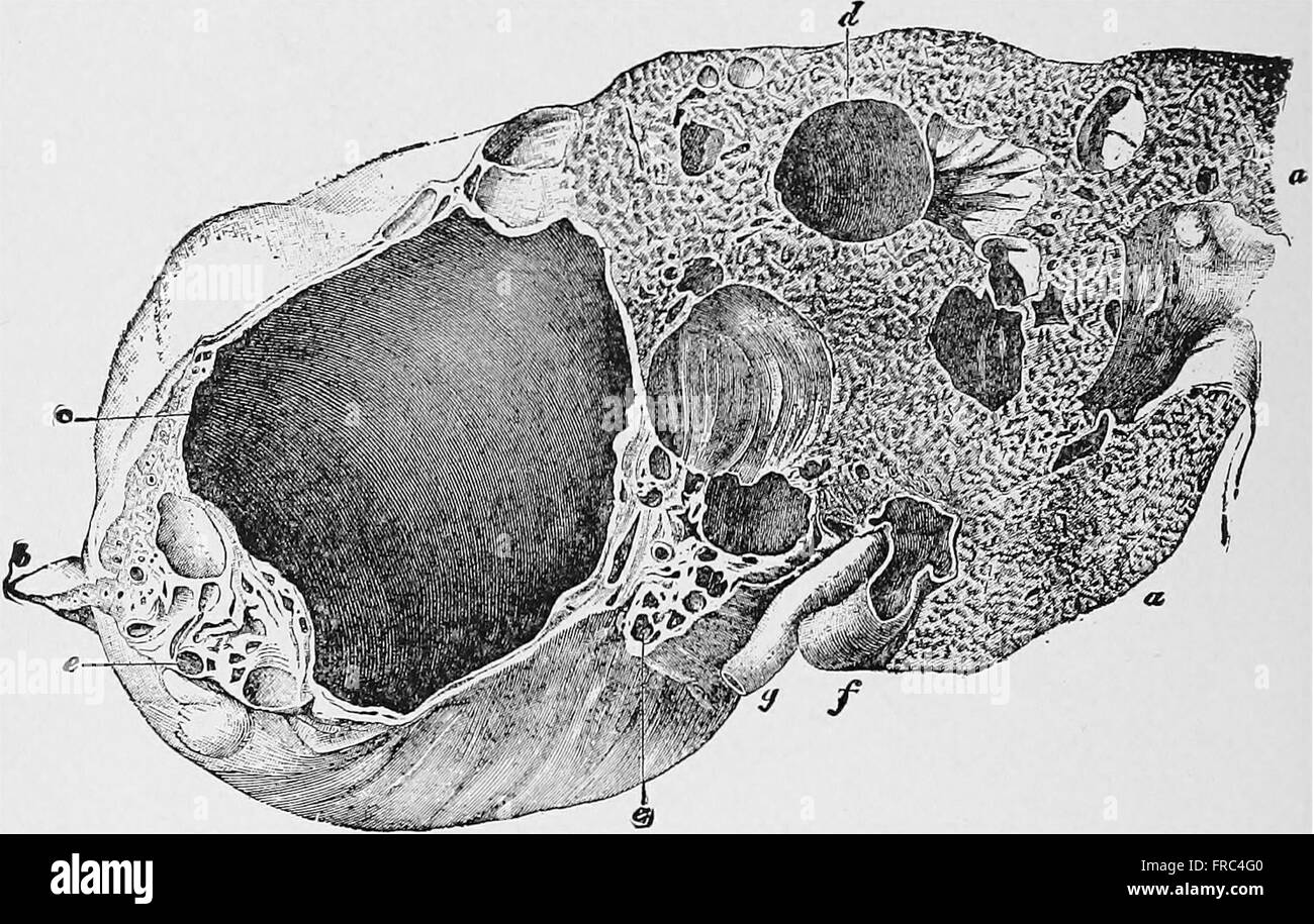 Cette édition 1921 de 'pathologie générale' offre un aperçu complet des principes de la pathologie, y compris l'étude des causes, des mécanismes et des effets de la maladie. Il est basé sur la 11ème édition allemande révisée, fournissant des informations scientifiques sur la recherche en pathologie et la compréhension médicale. Banque D'Images