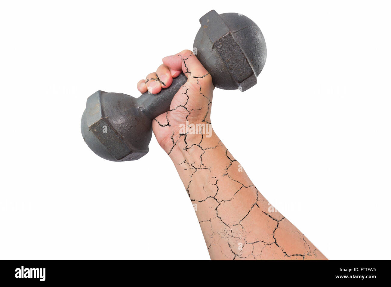 Fracture du bras droit et main tenant une haltère rétro isolé sur fond