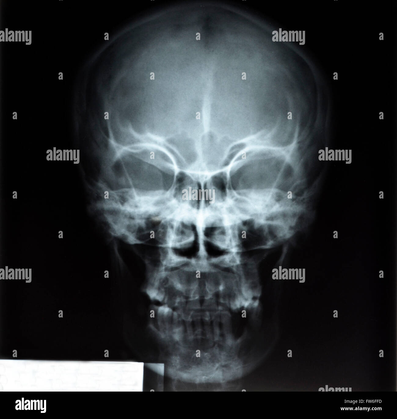 L'image des rayons x du crâne Banque D'Images
