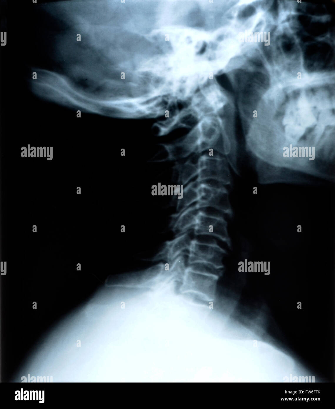 Détail de cou et de la tête x-ray image Banque D'Images