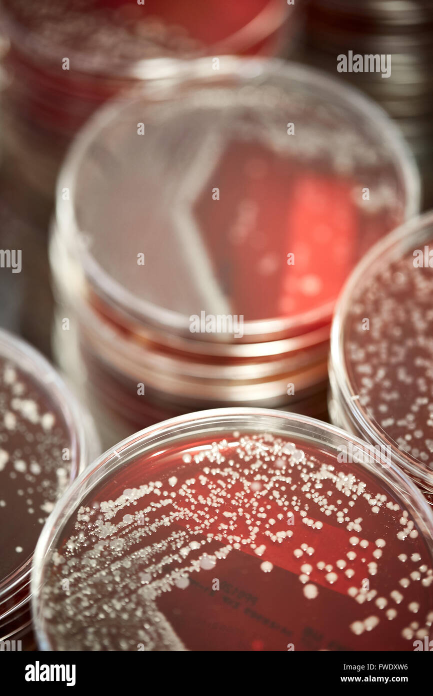 Les plaques de sang des échantillons liquides antibiotiques test lab laboratory tests tests en laboratoire l'analyse du sérum de patients analysés bl Banque D'Images