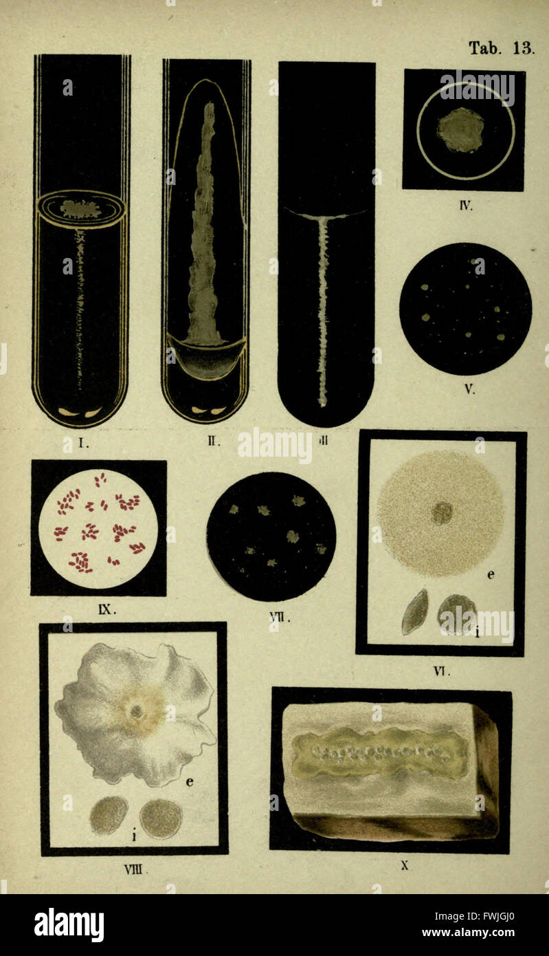 Atlas et essentiel de la bactériologie (tab. 13) Banque D'Images
