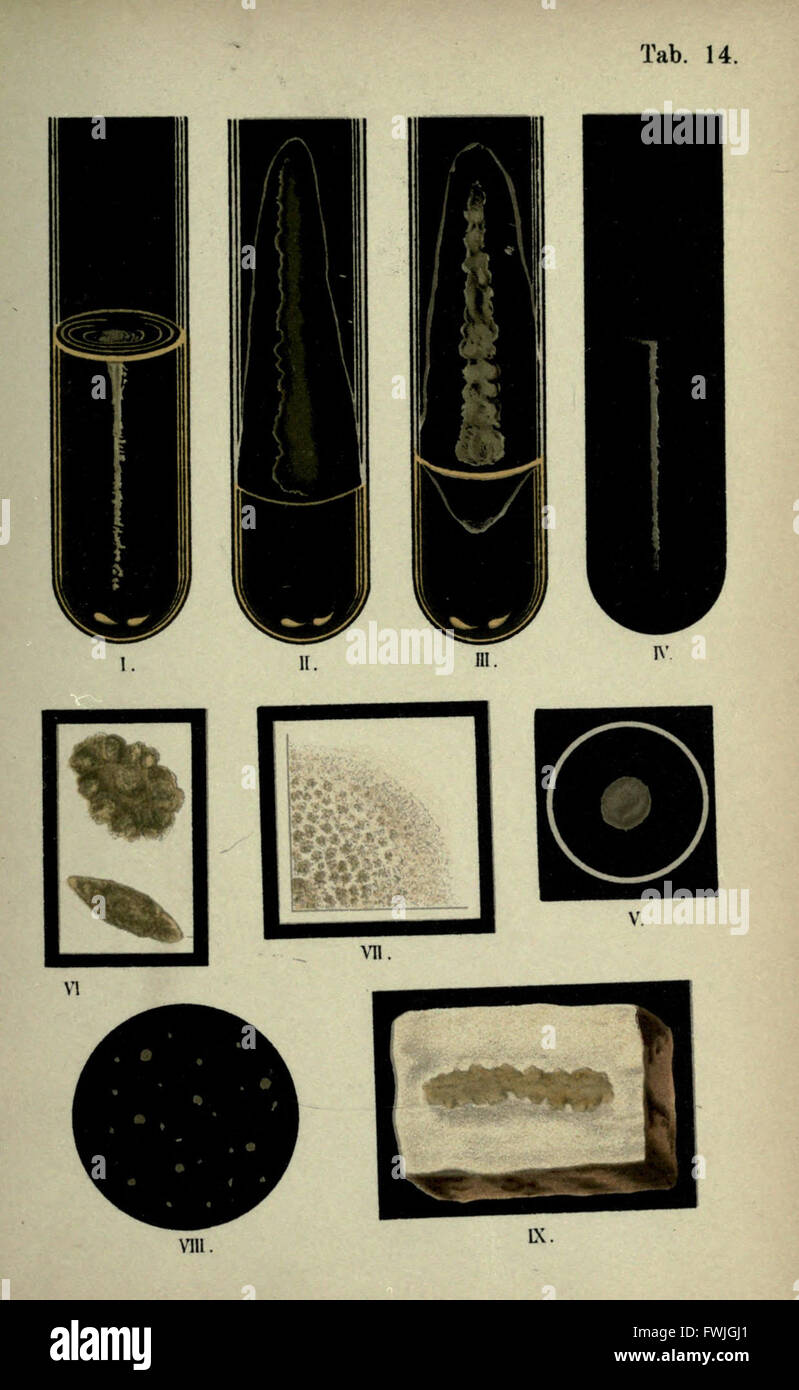 Atlas et essentiel de la bactériologie (tab. 14) Banque D'Images