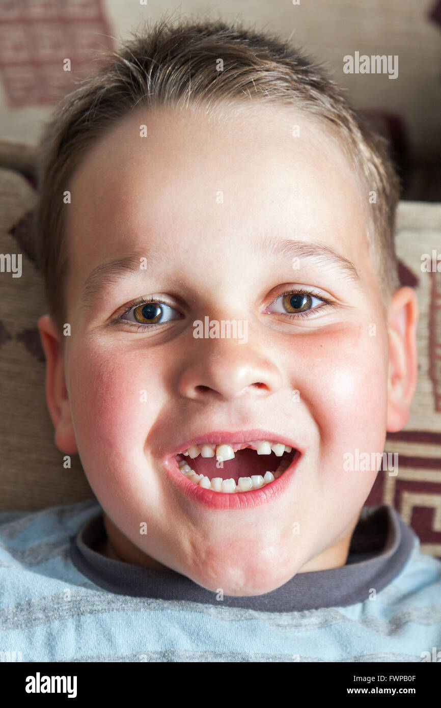 Petit garçon avec une première dent de lait avant déchiré Banque D'Images
