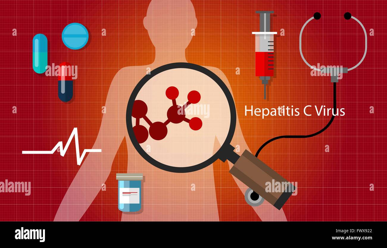 Vhc virus de l'hépatite C Santé traitement médical de la maladie du foie Illustration de Vecteur