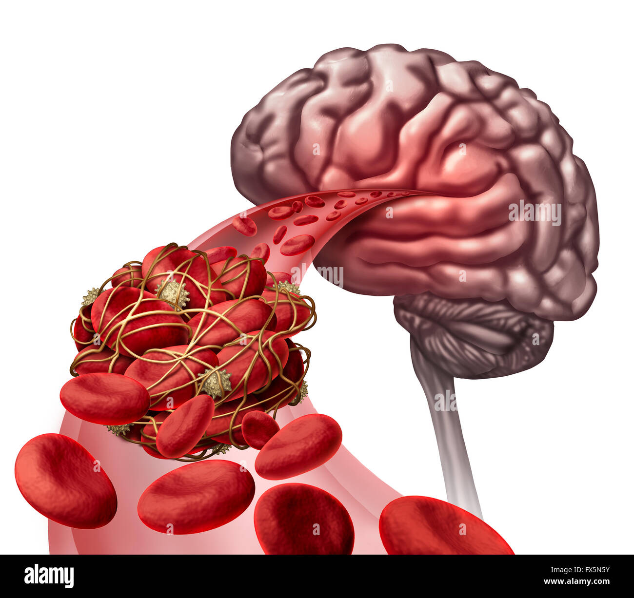 Caillot de sang au cerveau en tant que concept médical illustration 3D de cellules de sang bloqué par un blocage de l'artère provoquant un blocage du thrombus de la circulation sanguine dans l'anatomie de la neurologie. Banque D'Images