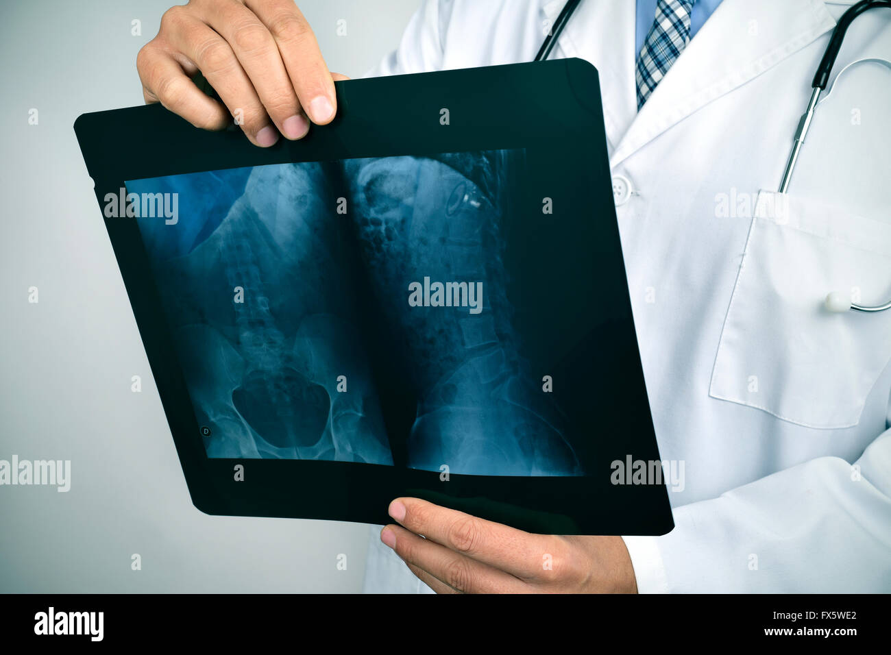 Libre d'un jeune homme portrait l'observation d'une radiographie du squelette Banque D'Images
