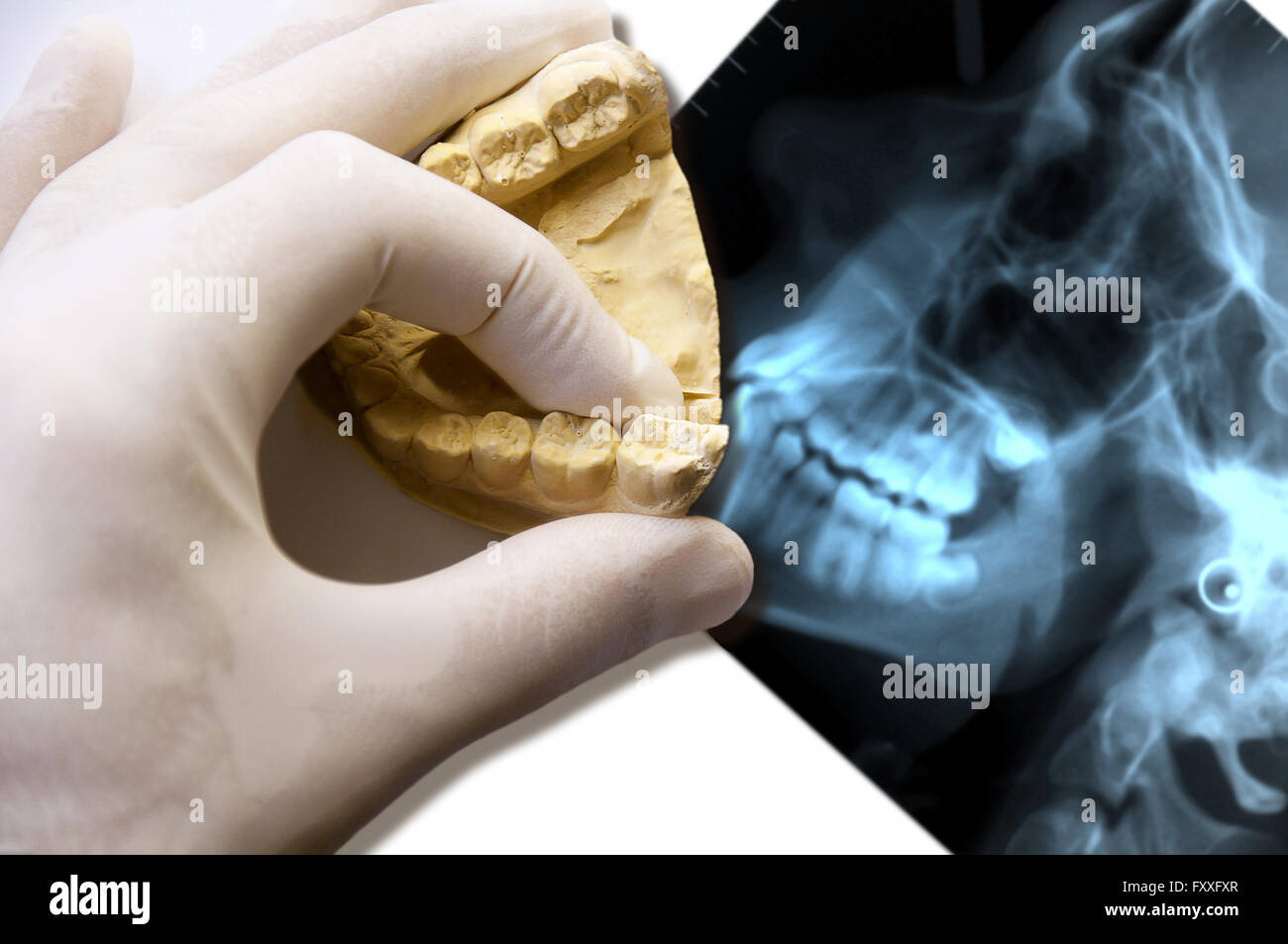 Dentiste part voir les molaires sur un x-ray Banque D'Images