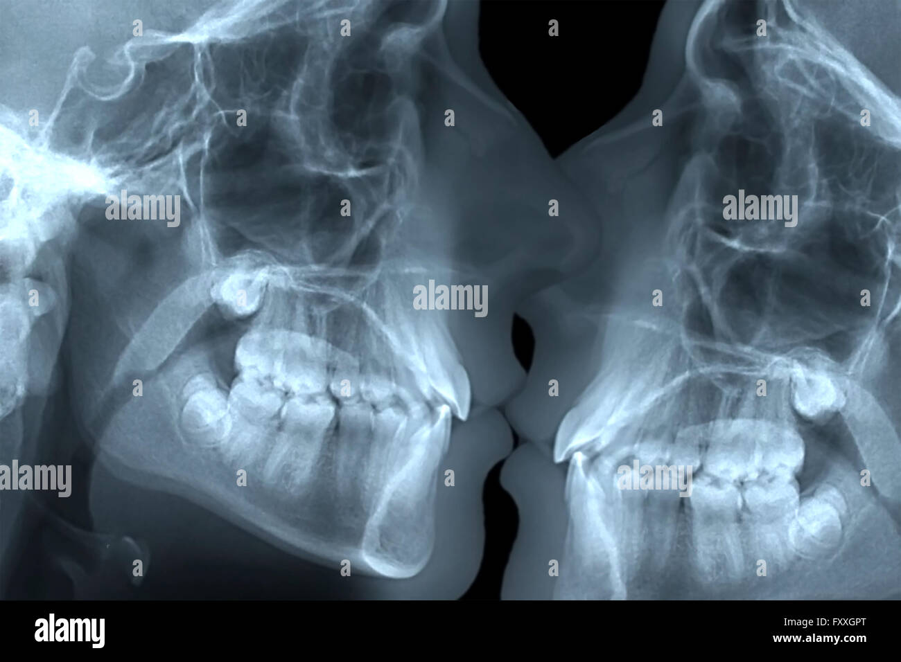 Soins médicaux : x-ray kissing Banque D'Images