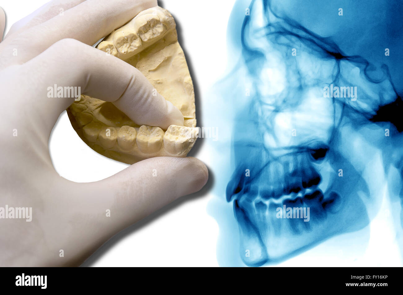 Dentiste part afficher plus de molaires céphalométrique analyse dentaire Banque D'Images
