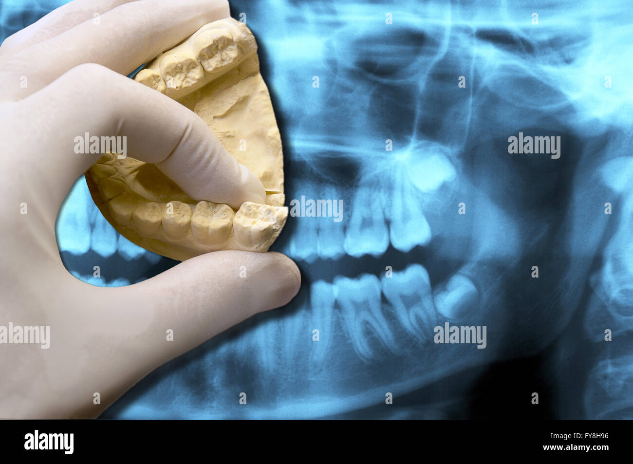 Dentiste montrant une molaire sur la radiographie dentaire panoramique Banque D'Images
