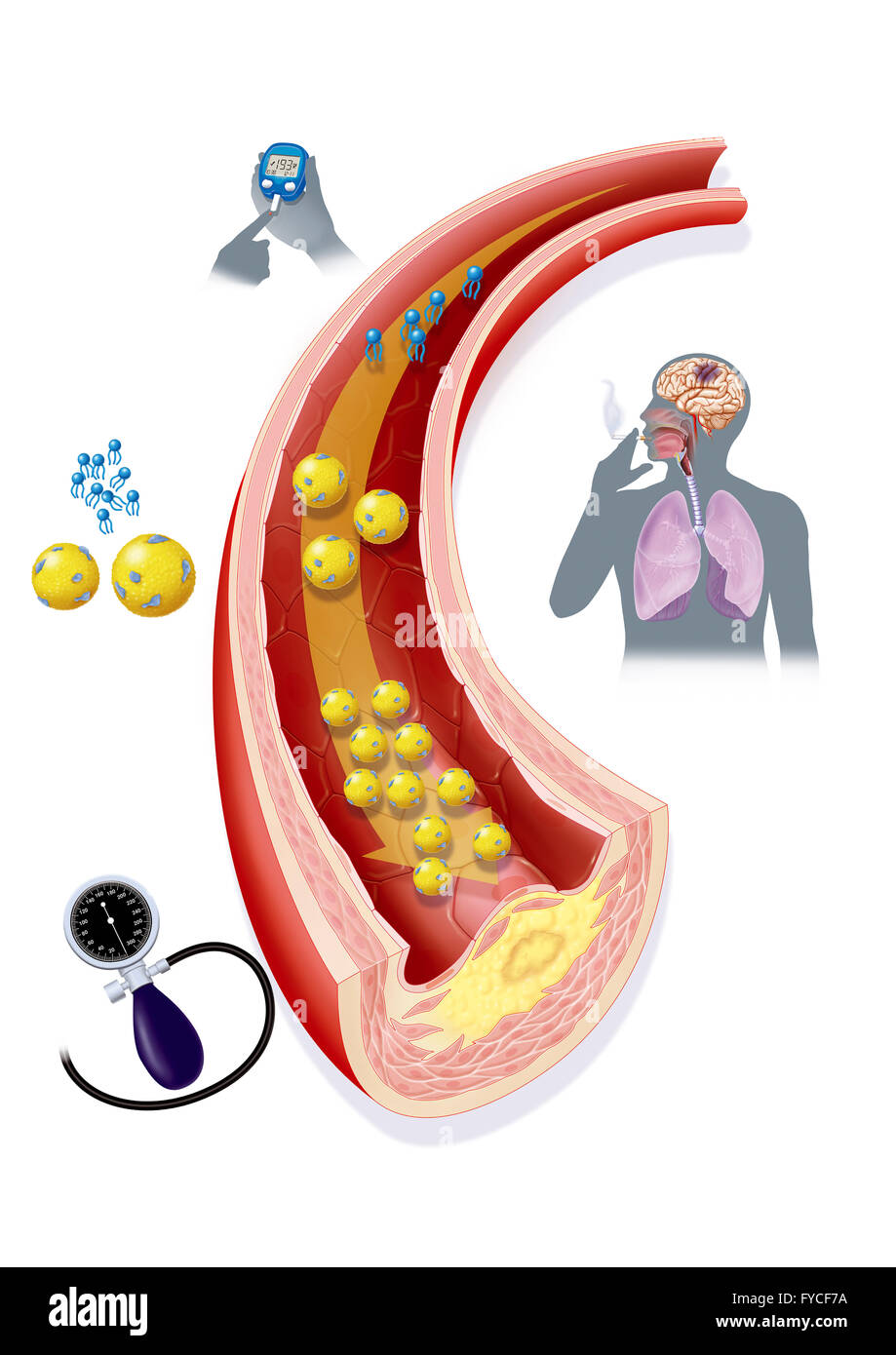 FACTEUR DE RISQUE Banque D'Images