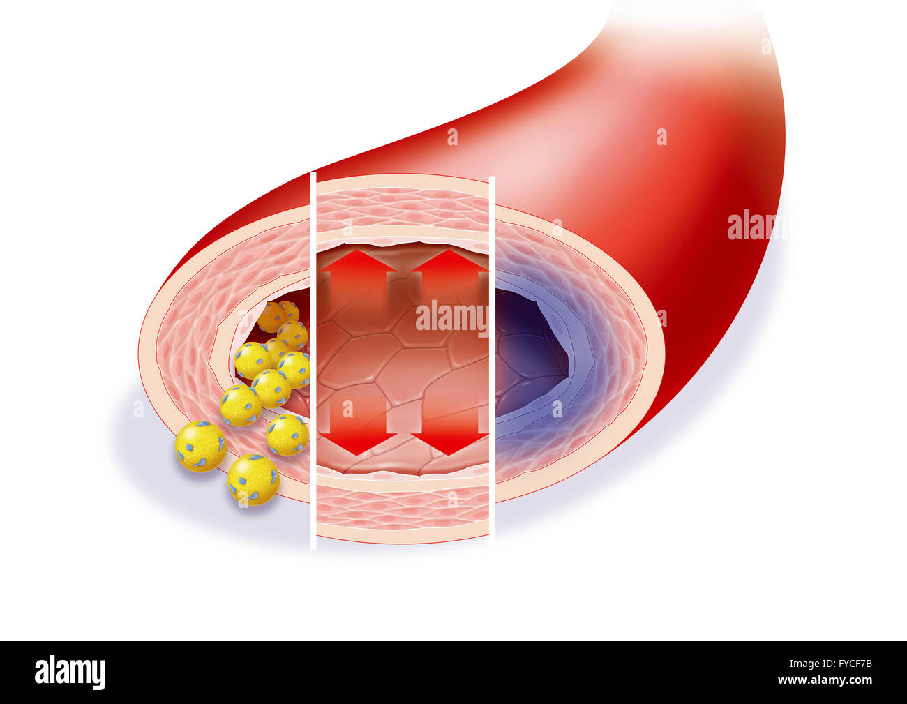 FACTEUR DE RISQUE Banque D'Images
