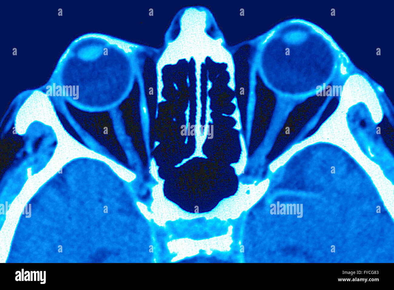 Nerf optique Banque de photographies et d’images à haute résolution Alamy
