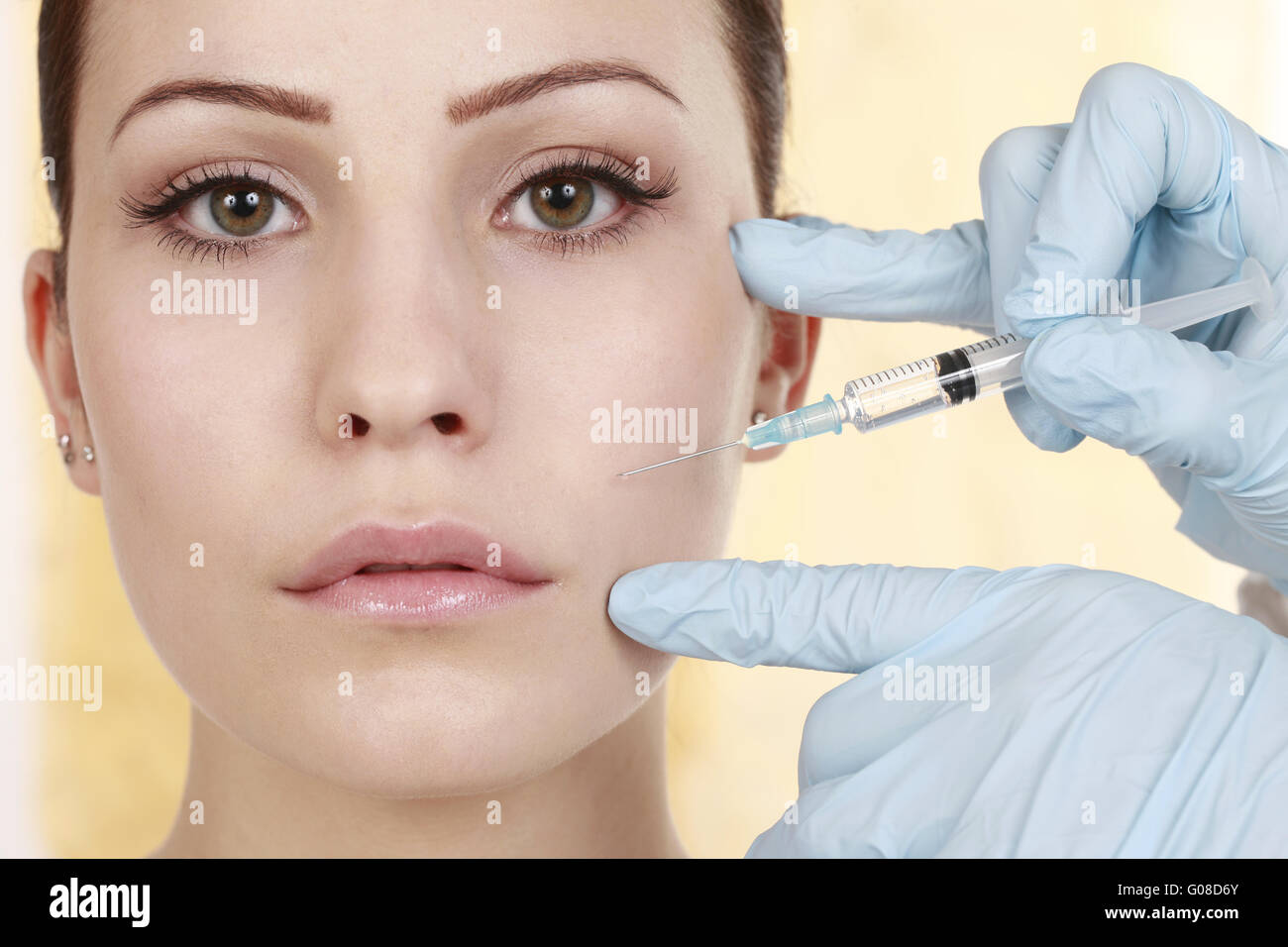 Le traitement du visage avec la toxine botulinique Banque D'Images