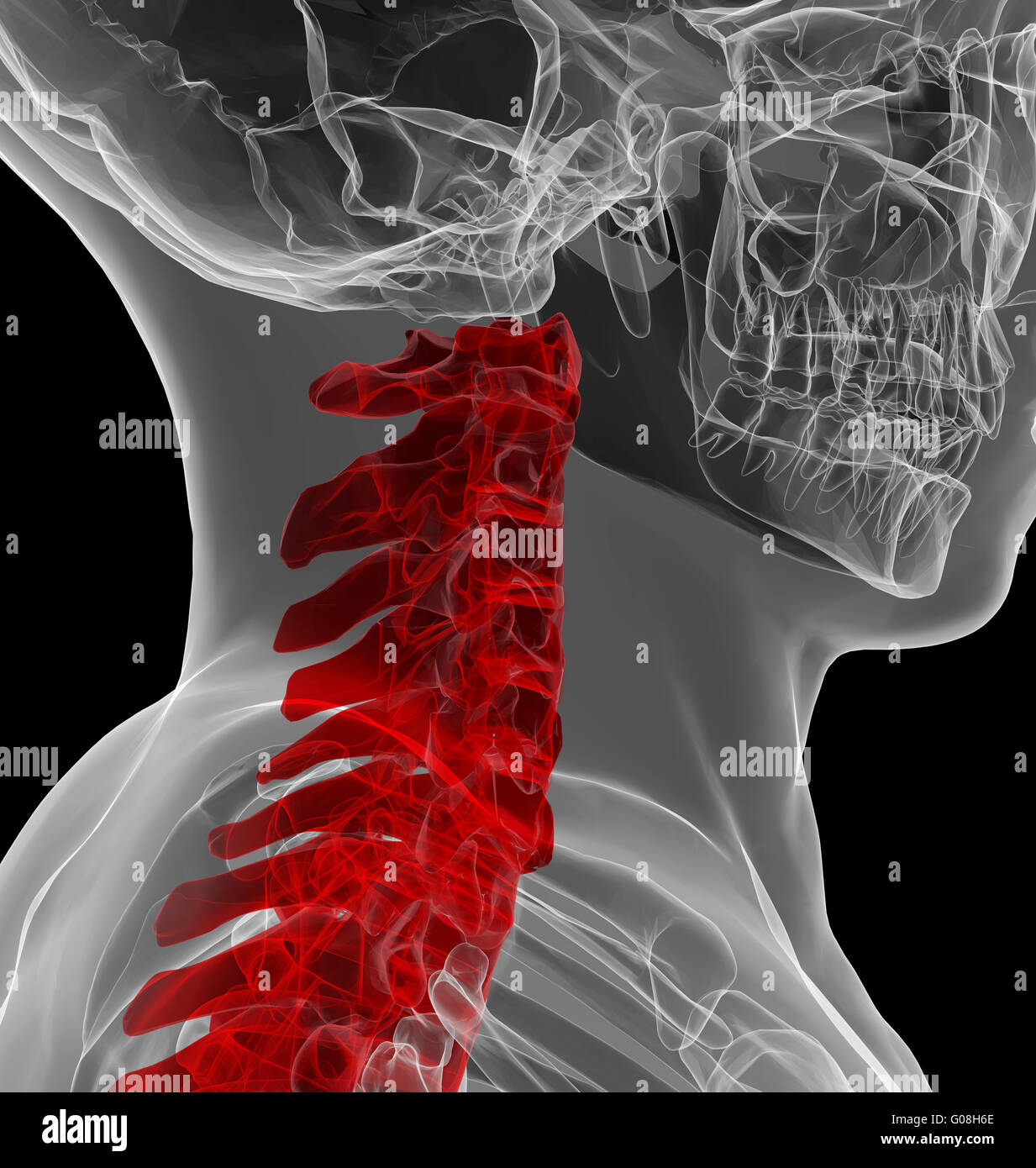 La vue X-ray de la colonne cervicale Banque D'Images
