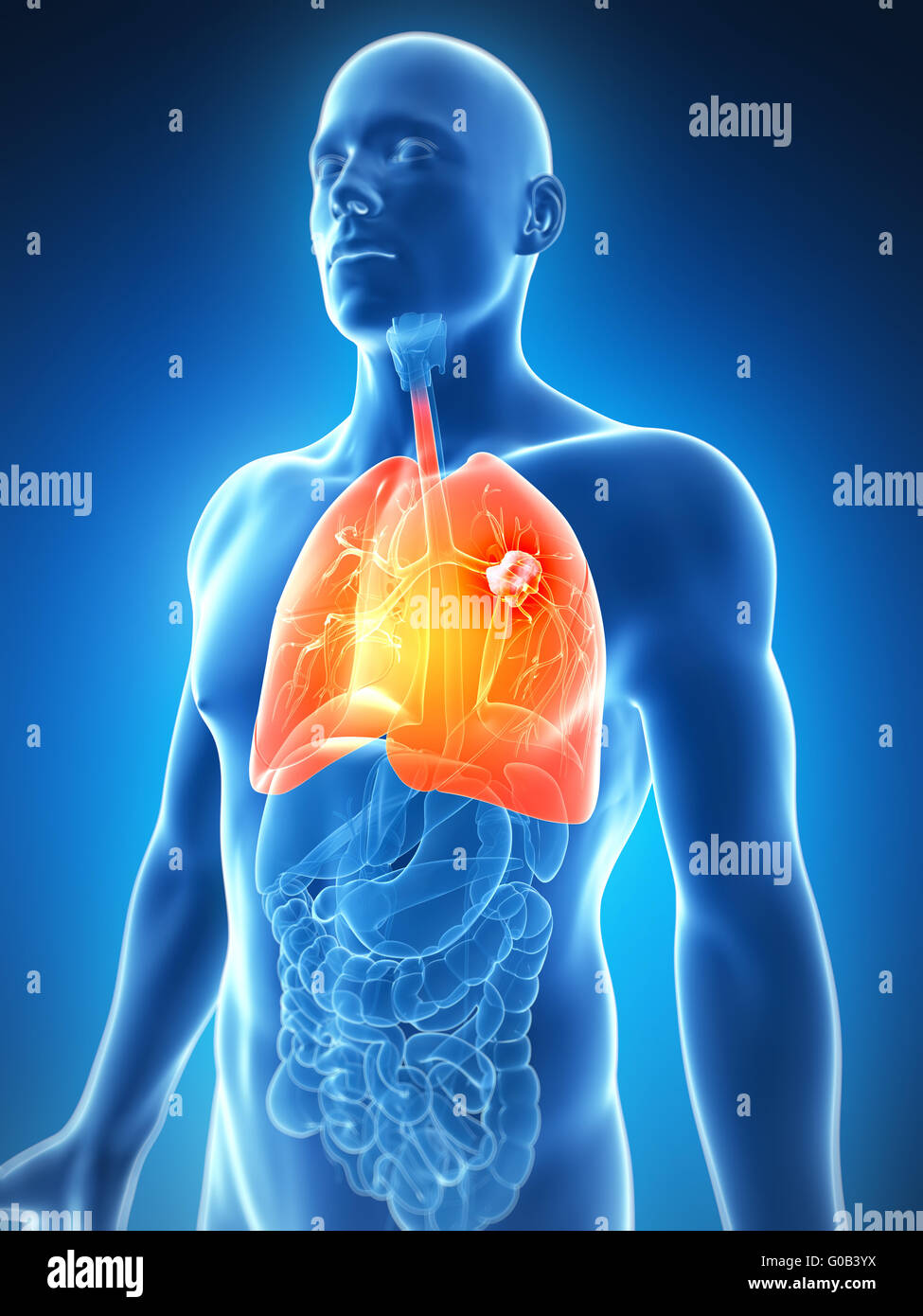 Rendu 3d illustration de l'homme - le cancer du poumon Photo Stock - Alamy