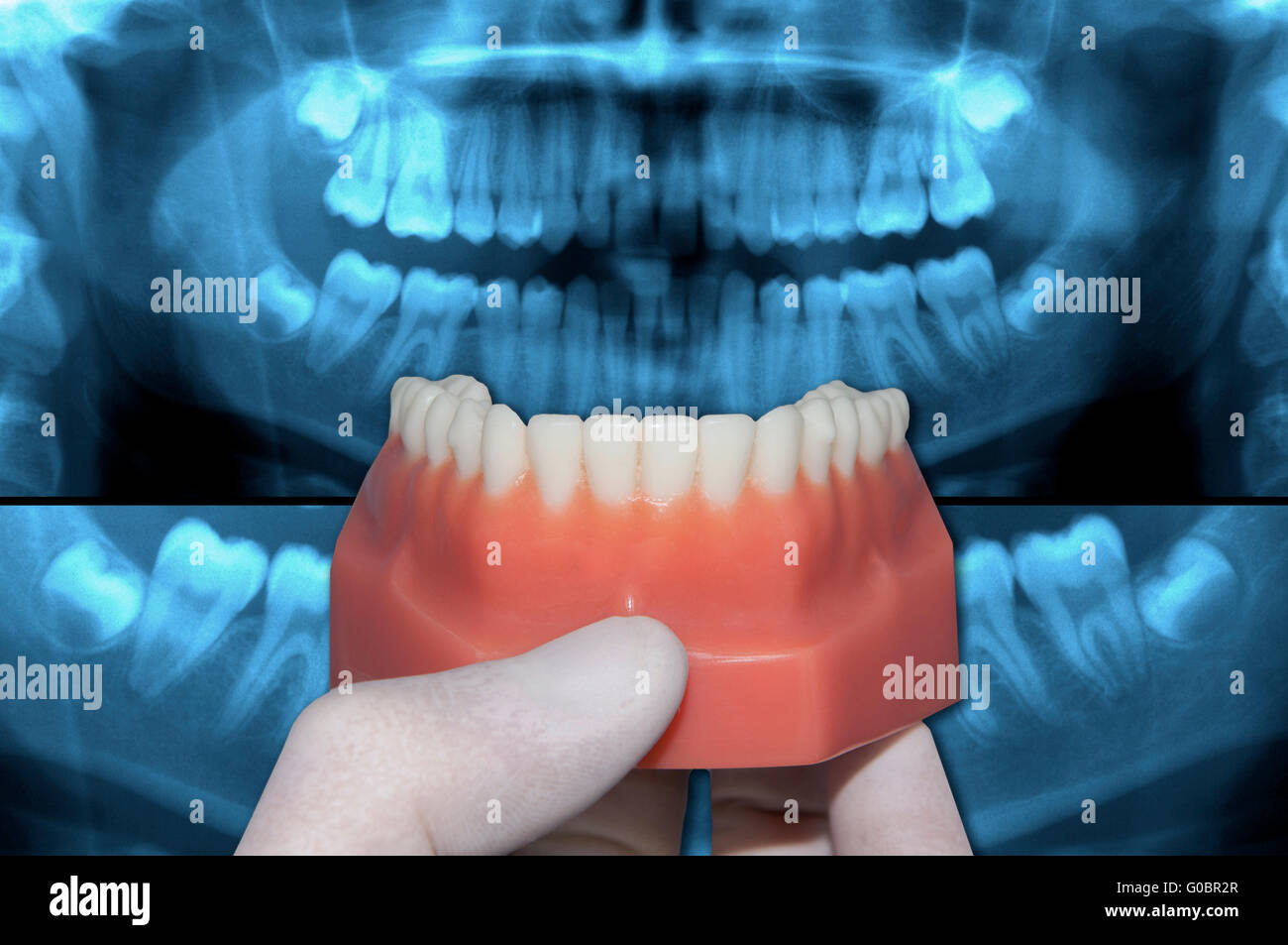 Dentiste montrent moins voûte au-dessus de x-ray dents Banque D'Images