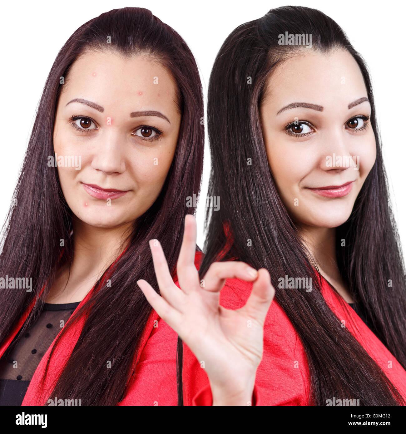 Femme avec des problèmes de peau sur son visage Banque D'Images