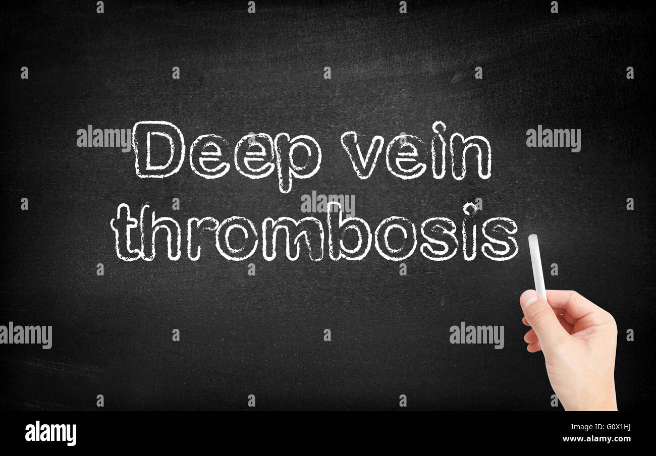 La thrombose profonde de veine écrit sur tableau noir blanc Banque D'Images