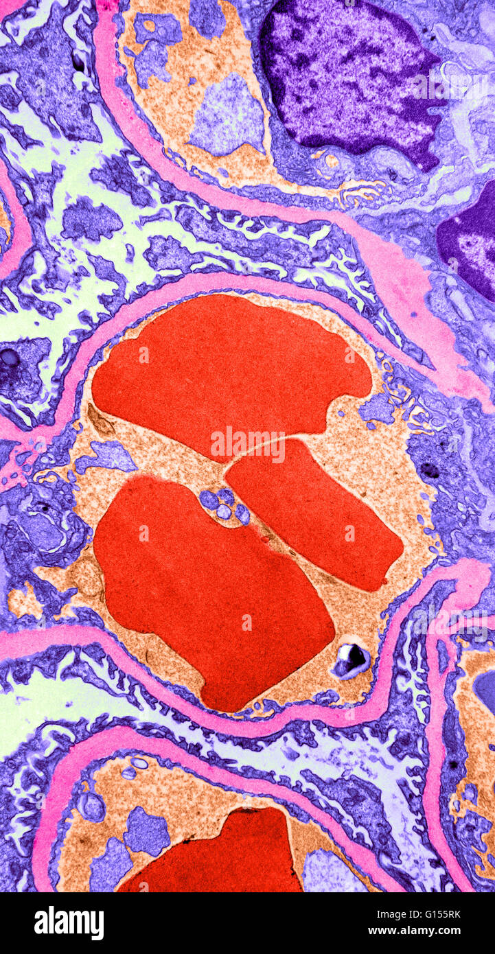 Globules Rouges Et Rein Histologie d'un glomérule Banque de photographies et d’images à haute ...