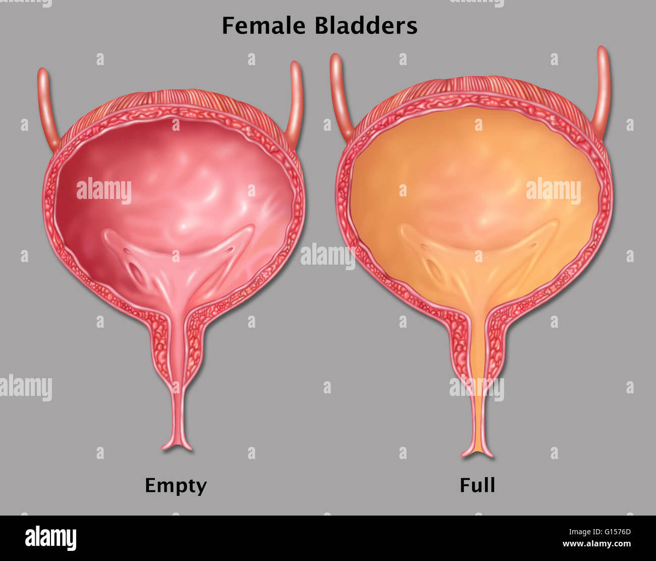 Illustration d'une femme, la vessie vide à gauche et remplie d'urine à droite. Que la vessie se remplit la vessie pousse vers le bas, favorisant l'écoulement de l'urine hors de la vessie par l'urètre. Banque D'Images