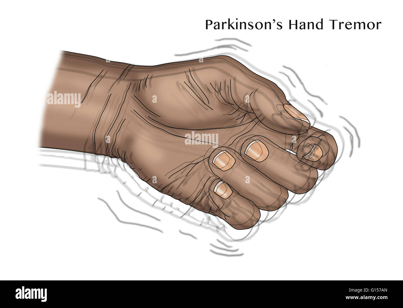 Illustration d