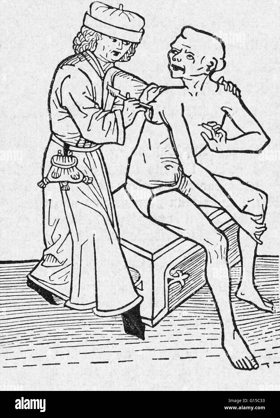 L'un des premiers exemples connus d'un médecin lancing une blessure -- ici, une vésicule ou bouillir sur une victime de la peste. Banque D'Images