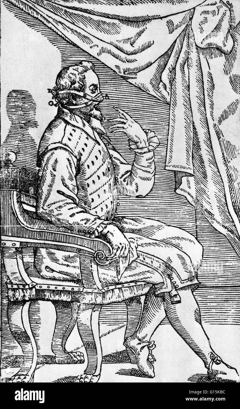 L'un de Gaspare Tagliacozzi les méthodes utilisées pour le remplacement d'un nez manquant. Nous voyons ici comment les bandages (B, C) tenir le nouveau nez (A) jusqu'à ce qu'il pousse en place. Gaspare Tagliacozzi (1547-1599) était un chirurgien plastique. Bien que la chirurgie réparatrice Banque D'Images