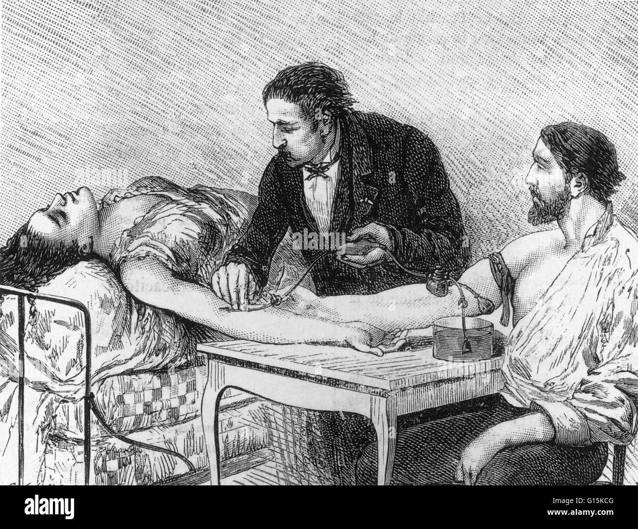 Intitulé : "directes" de la transfusion de sang en direct effectué le 7 février 1882 par le Dr Roussel." Un lien direct, de personne à personne de la transfusion, menée à Genève, en Suisse, au début de 1882. Le destinataire était une femme qui s'affaiblit après avoir donné naissance t Banque D'Images