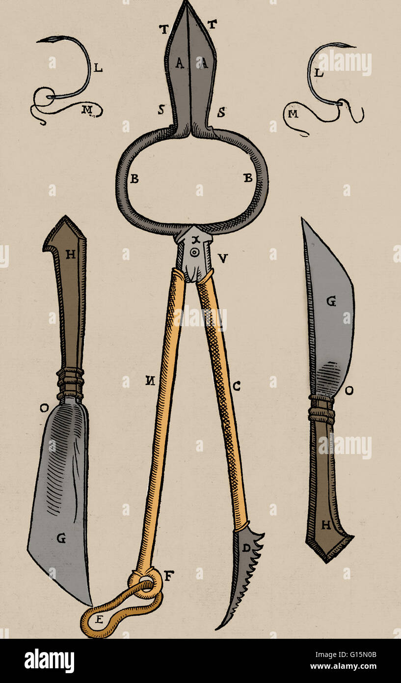 Certains équipements requis pour Gaspare Tagliacozzi Méthode de plus en plus d'un nez de remplacement à partir de la peau du bras. Ces instruments spéciaux sont utilisés pour sculpter la nouvelle cloison nasale. Gaspare Tagliacozzi (1547-1599) était un chirurgien plastique. Bien que restauratrices Banque D'Images