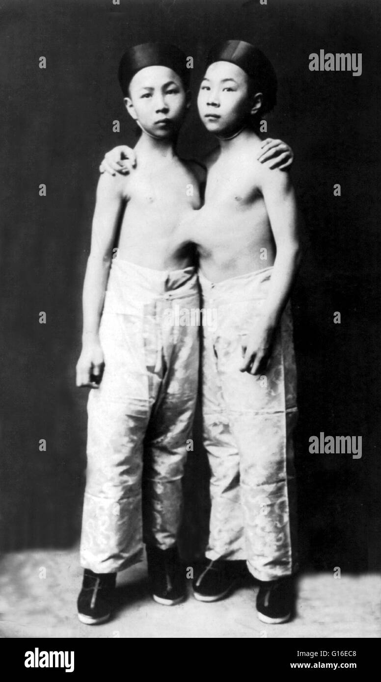 Intitulé : 'La jumeaux en 1903, âgés de 7 ans. Jumeaux siamois et Tang-Sen Seng-Sen Liou Liou est née à Nanjing, Chine, en 1886, ou à peu près. Leur critique a été classé comme xiphopagus, ce qui signifie qu'ils ont été jointes entre le nombril Banque D'Images