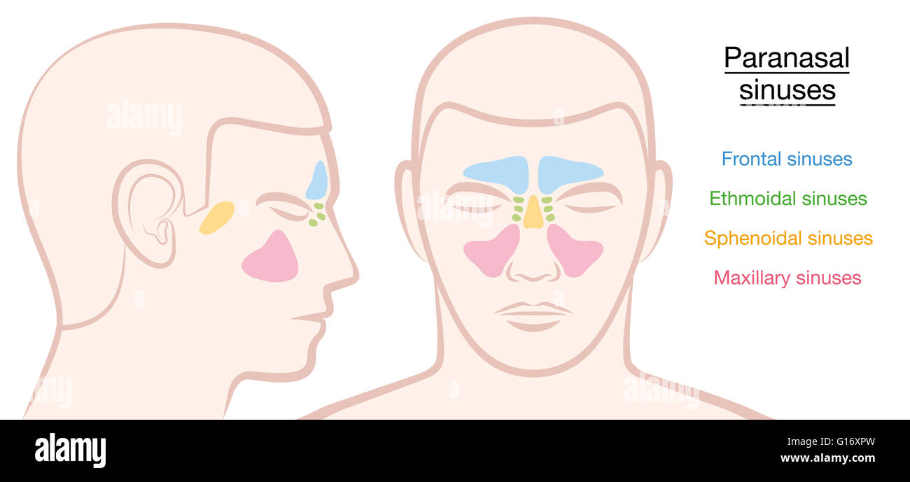 Sinus paranasaux sur un visage masculin en différentes couleurs - frontaux, ethmoidal sphénoïdales, maxillaire et sinus. Banque D'Images
