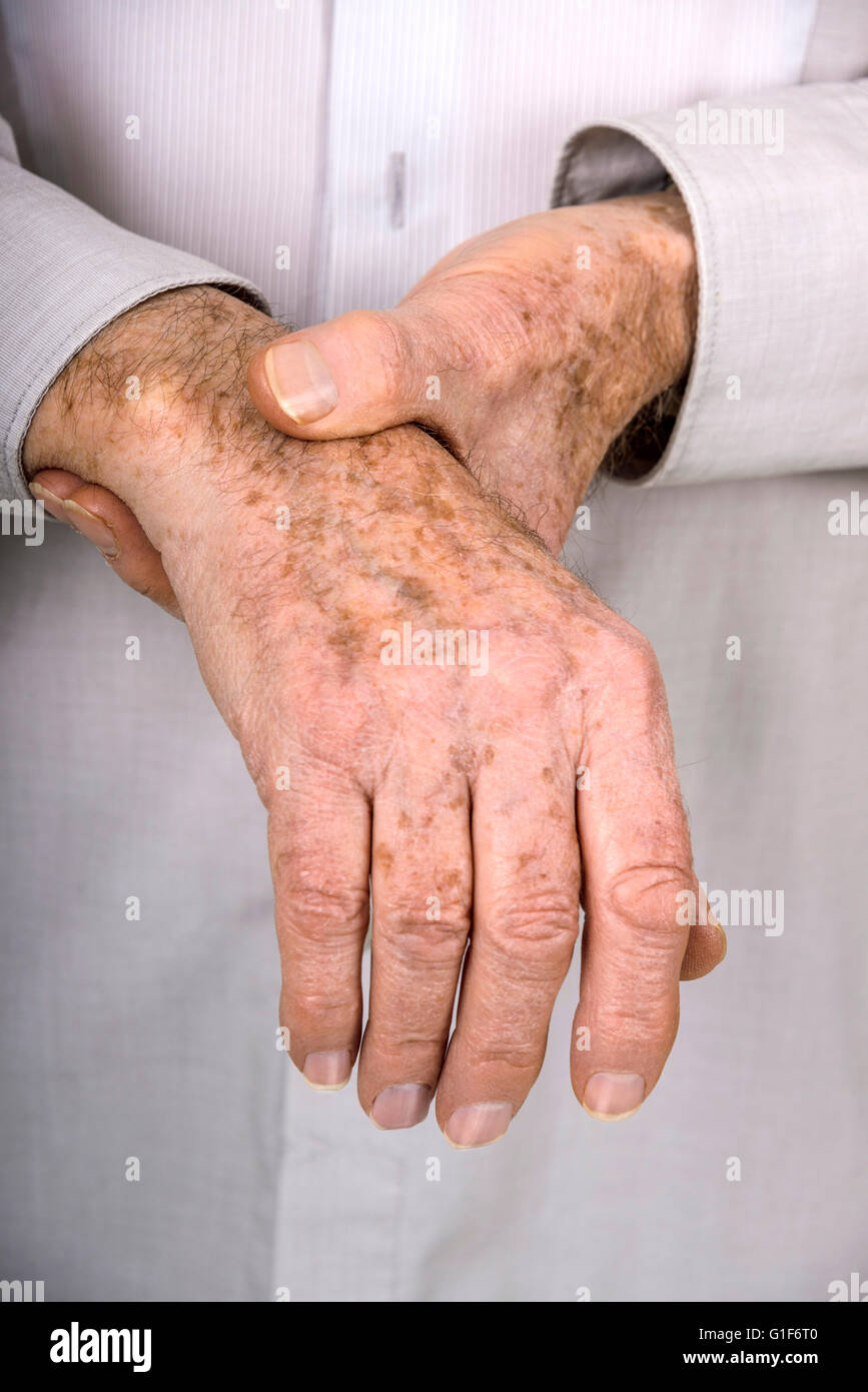 Parution du modèle. Senior man holding son poignet. Banque D'Images